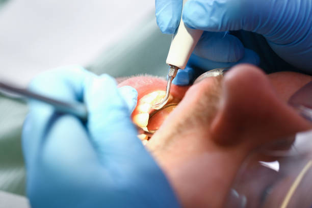 Best Urgent Tooth Repair  in Hurricane, UT